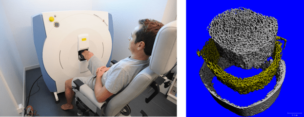 on the left, an man sits with his leg in a CT scan machine. On the right is a layered tomography image of his bone structure.