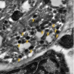 Transmission electron microscopy (TEM) imaging: high electron density vesicles (yellow arrows) typical of catecholamine-containing chromaffin cells found in cardiomyocytes