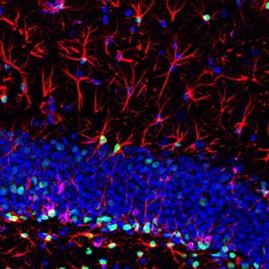 sample of brain tissue with a curving blue line made of small dots and red neural networks moving above and below
