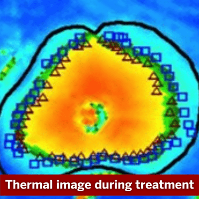Thermal imaging