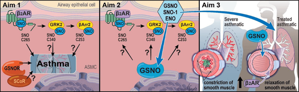 Graphic depicting the Gaston Lab's 3 Project Aims. 1: Define the role of S-nitrosylation of specific β2AR signaling components (β2AR, GRK2, β-Arrestin2). 2: Determine if drugs that elevate GSNO (SNO-donors or SNO reductase inhibitor), through actions on the pulmonary β2AR signaling system, can prevent or correct the development of airway hyper-responsiveness in a pre-clinical murine model of asthma. 3: Demonstrate that inhaled GSNO will improve both FEV1 and β2-agonist responsiveness in the severe asthma patient subpopulation.
