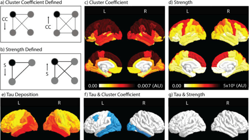 Images of brain scans for Alzheimer's