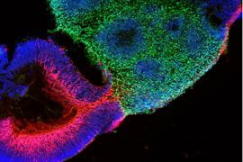 A multicolored microscopic cell.