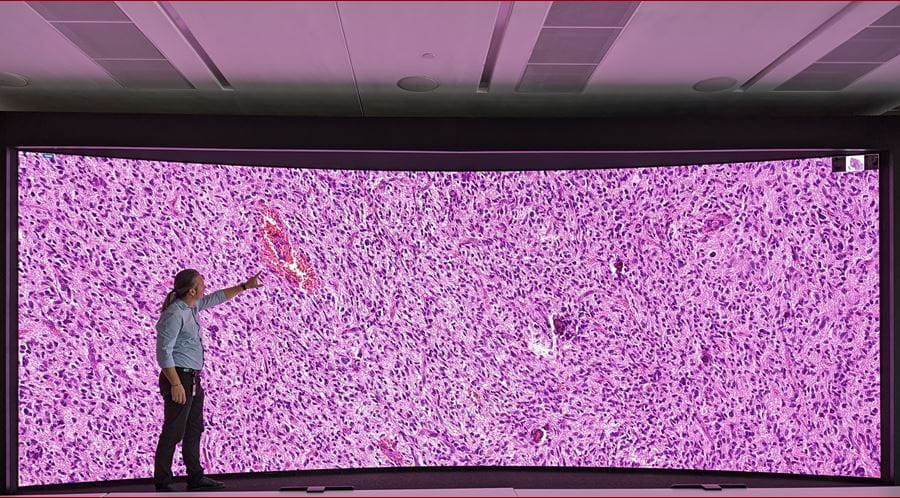 Spyridon Bakas, PhD looks at a tissue slide of a brain tumor on the Crystal Display Wall at the Cyberinfrastructure Building at Indiana University Bloomington.